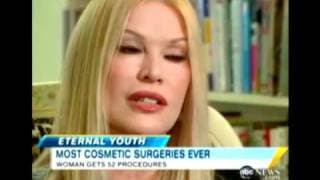 Most Plastic Surgeries Ever - Cindy Jackson World Record