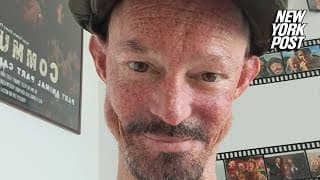 ‘Game of Thrones’ actor Darren Kent dead at 36 after health battle