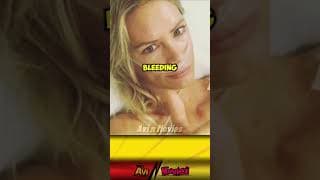 "Did You Know? The Shocking Stunt Accident of Olivia Jackson in Resident Evil"